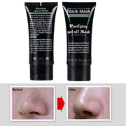 Amazing Blackhead Removal & Deep Cleaning Face Mask